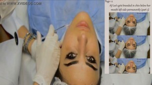 AJ Lee chin and feet mole implants (permanent)